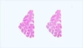 Frozen Tissue Section - Human Adult Normal: Heart: Atrium (left)