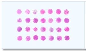 Multiple Tumor Tissue Array - 7 different normal tissues and 5 major tumor types in duplicates for IHC antibody and ISH 